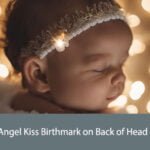 Angel Kiss Birthmark on Back of Head Spiritual Meaning